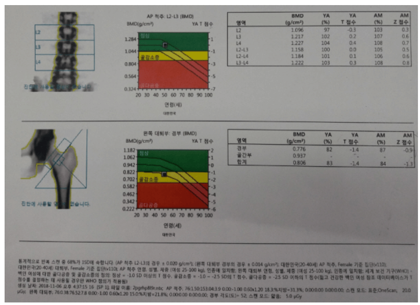 골다공증 검사비용 골밀도 검사 무상지원