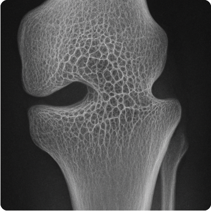 영상의학의 눈, 검출기의 해상도 차이가 주는 임팩트