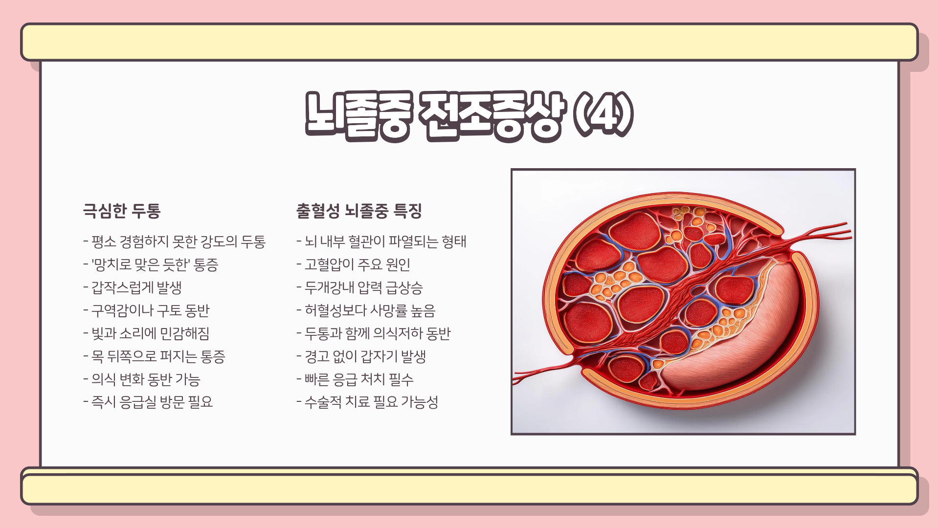뇌졸중 전조증상 | 뇌졸중 예방법 | 뇌졸중 검사방법 완벽정리, 놓치면 돌이킬 수 없다