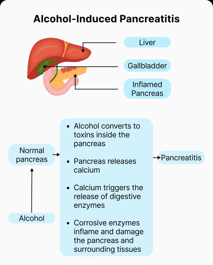 술과 췌장 건강