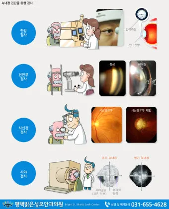 녹내장 진단 검사 비용 안압 검사주기 관리법_36