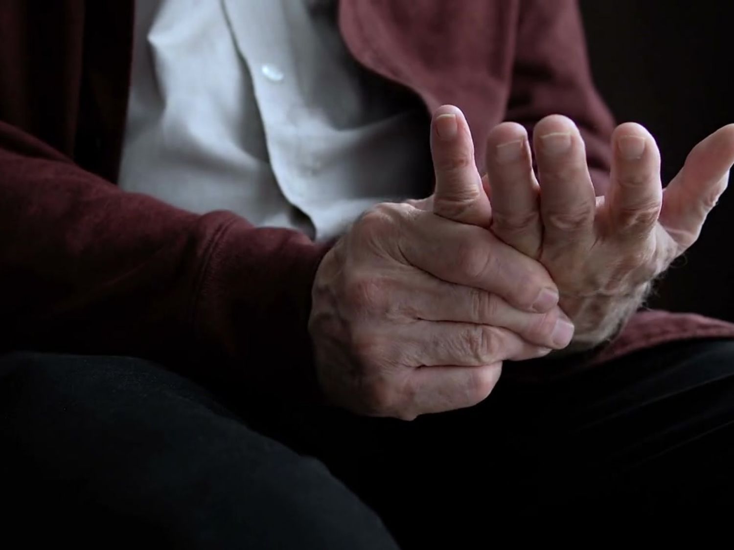 손가락 퇴행성 관절염