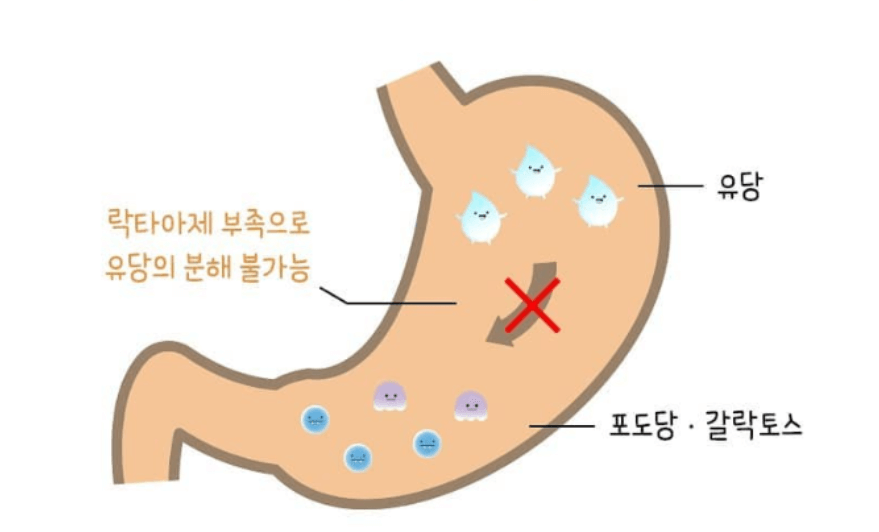 유당불내증