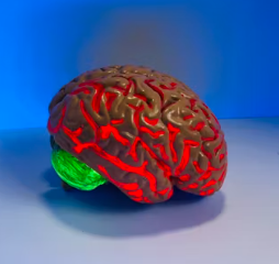 뇌졸중 치료방법 진단 합병증