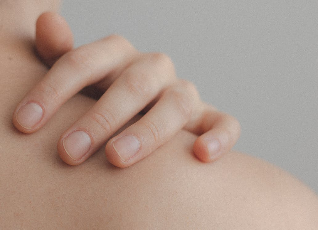 모기 물리면 어떻게 해야 할까?