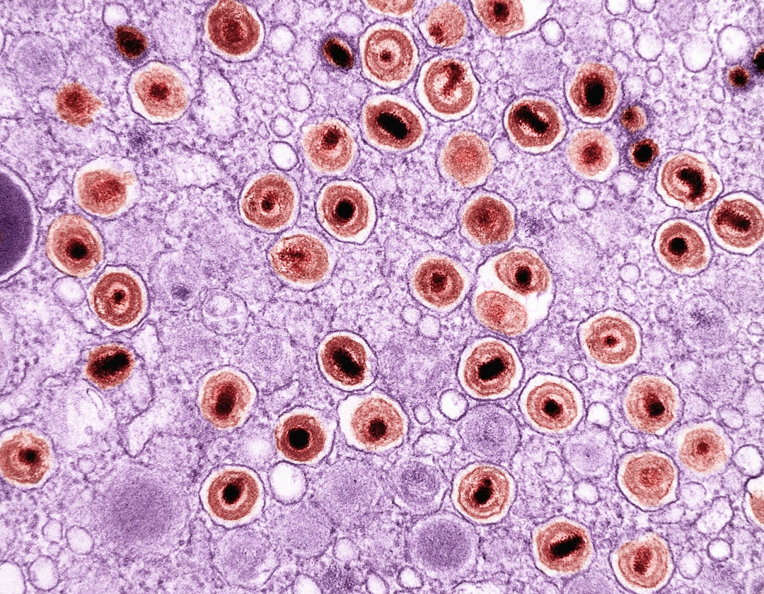 Herpes