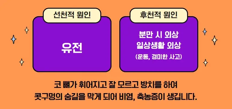 비중격-만곡증-원인