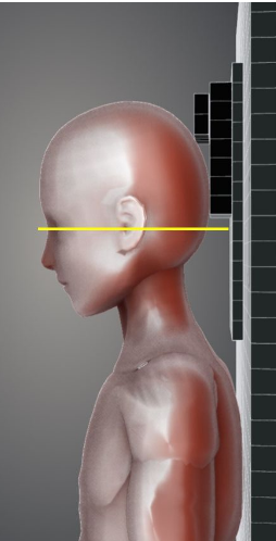 전후방향 촬영법