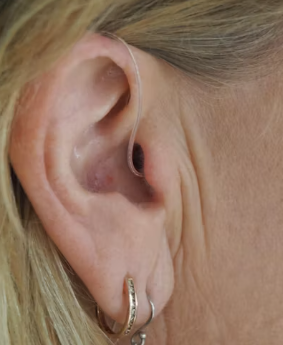 이명 치료법 진단 기준 합병증 관리