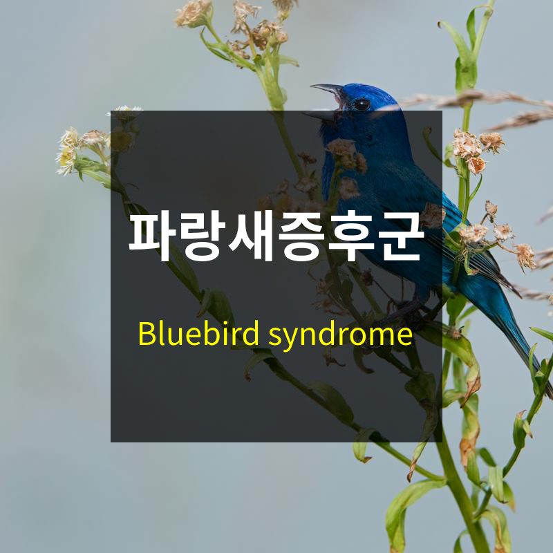 파랑새 증후군