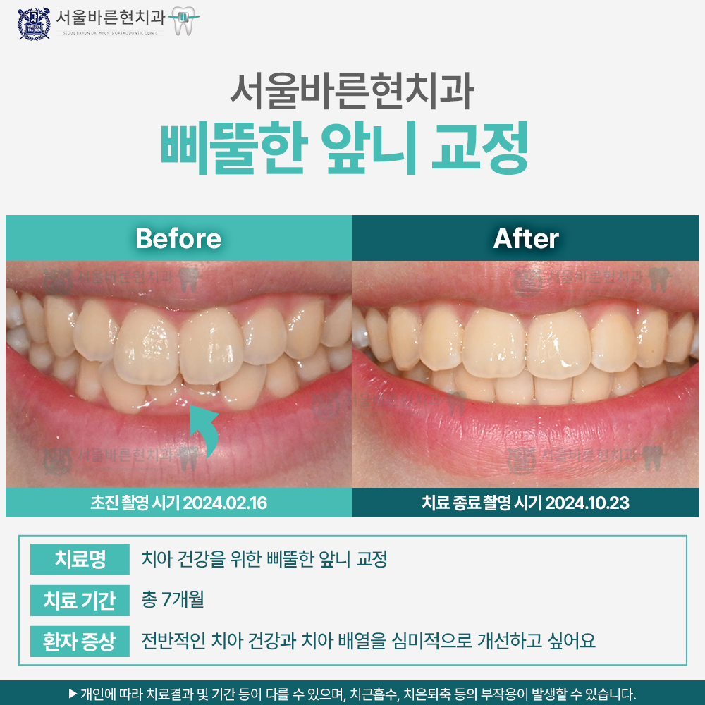 해운대교정치과