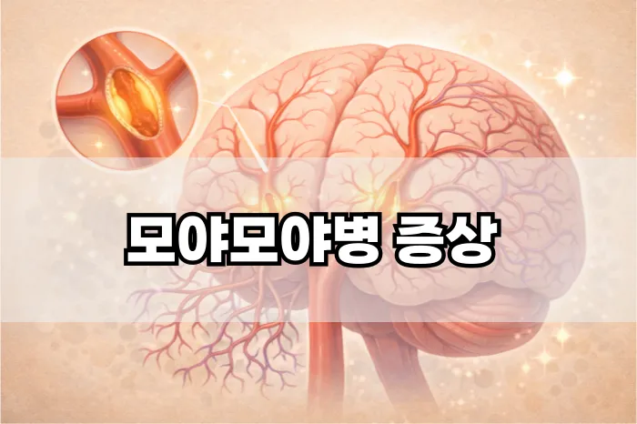 모야모야병 증상