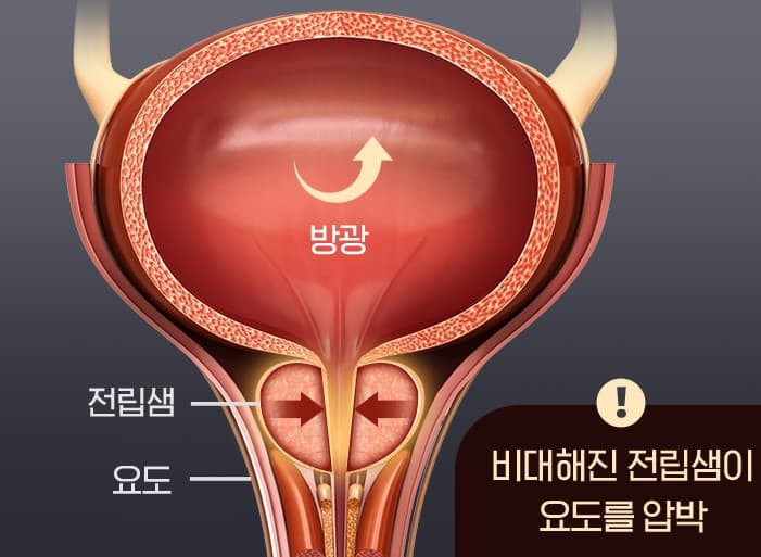 카리토포텐 효능