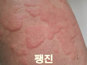 팽진