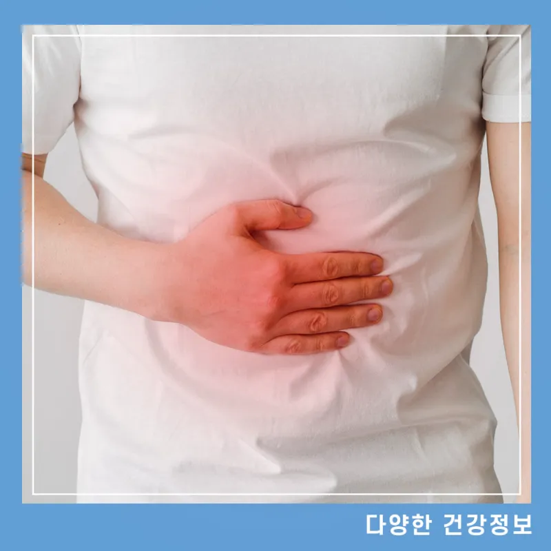 크론병-증상-수술-완치-치료방법