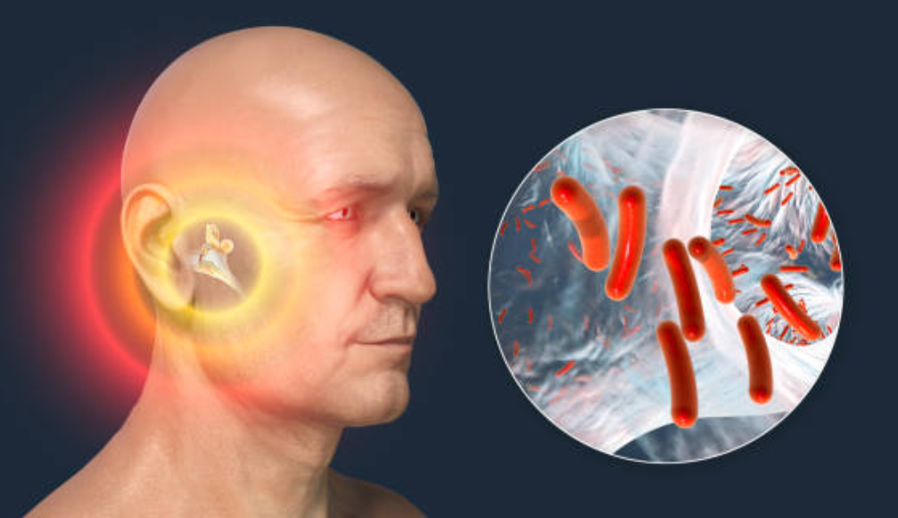 이석증과 관련된 사진2