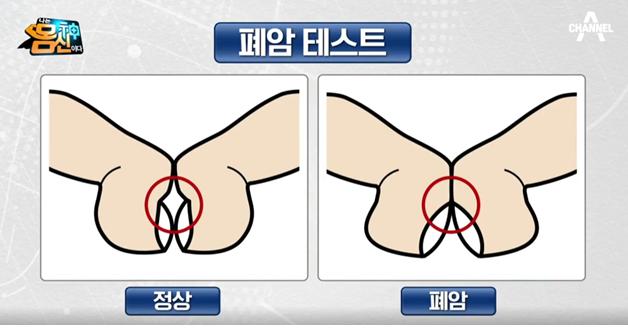 폐암 자가진단 방법