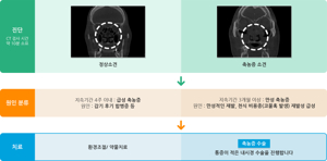 축농증수술