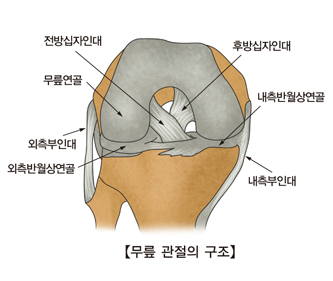 무릎 관절 연골