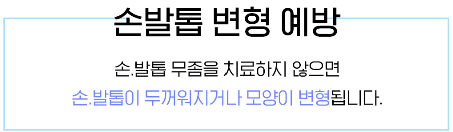 손발톱 변형 예방