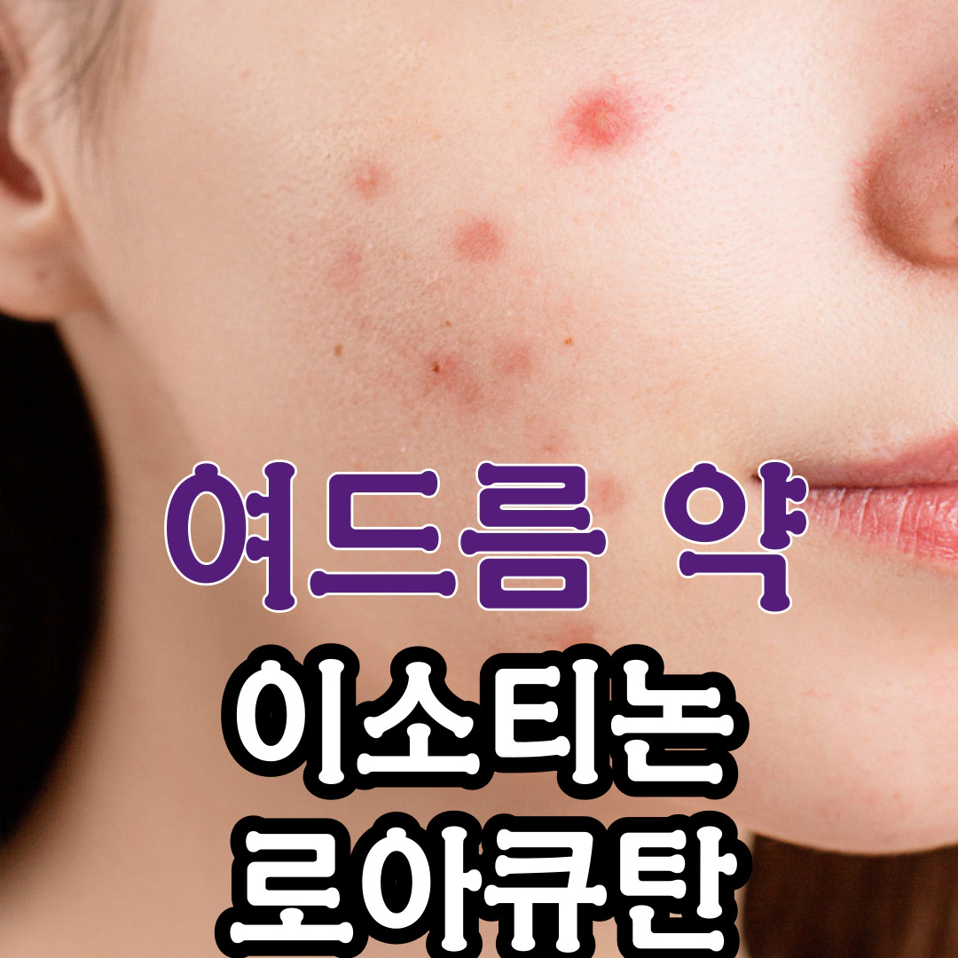 여드름 약 이소티논과 로아큐탄. 로아큐탄은 더이상 유통되지 않는다.