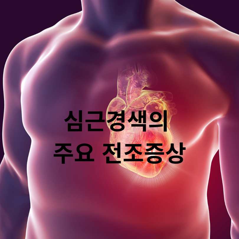심근경색 전조증상 자가테스트와 심근경색에 좋은 음식