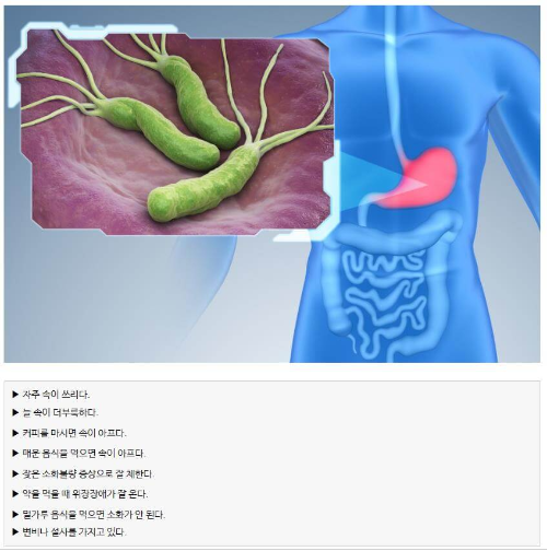 헬리코박터_감염증_자가진단