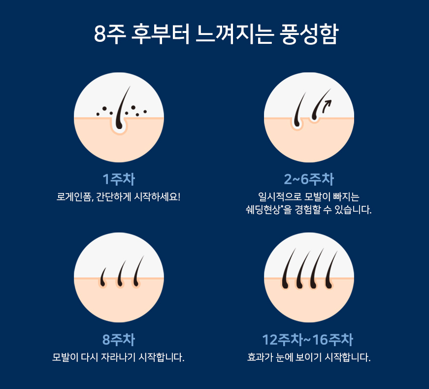 로게인폼 16차