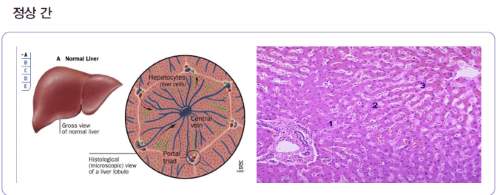 B형 간염 정의 특징 치료 예방