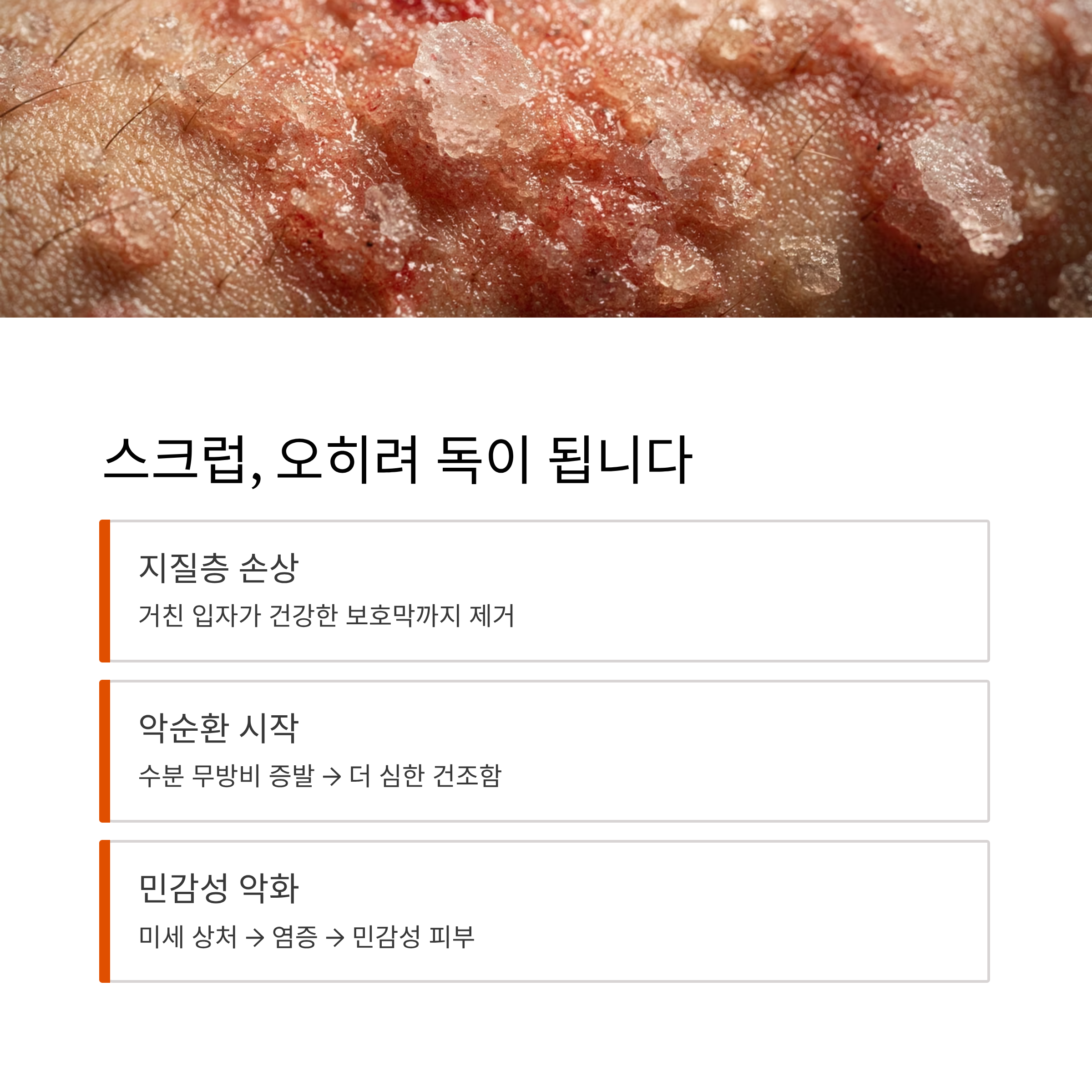 스크럽 위험성