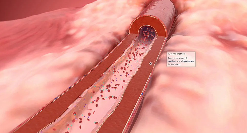 고혈압 낮추는 방법