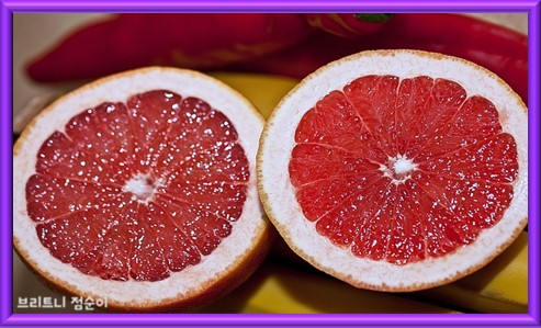 요로결석 증상 요로결석 피해야 하는 음식