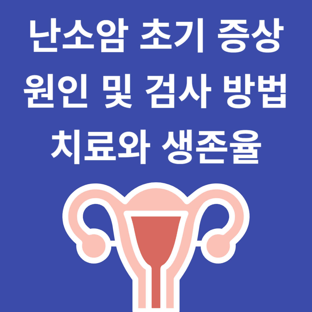 난소암 초기 증상, 원인 및 검사 방법, 치료와 생존율