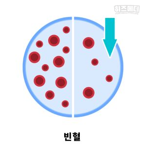 기립성 어지럼증
