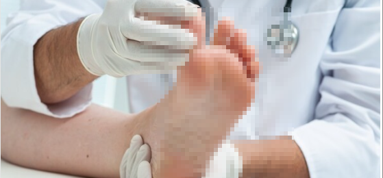 발톱무좀 치료 방법 및 예방법3