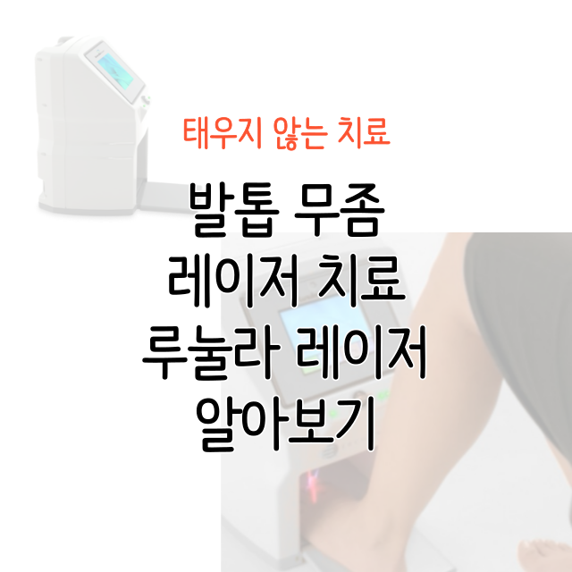 발톱무좀-레이저-치료-루눌라레이저