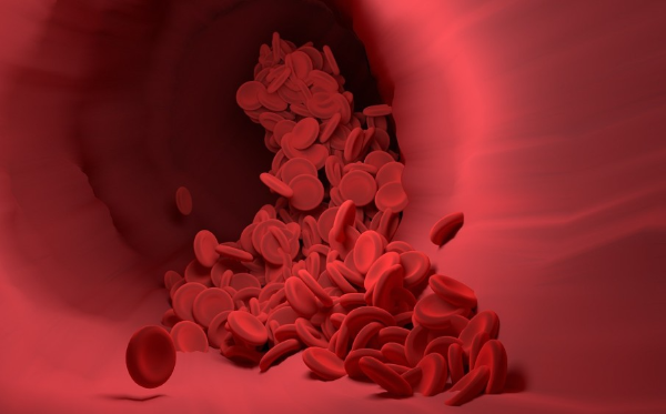 심장혈관계 의학용어 어근 상세한 정리