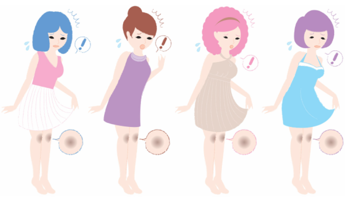 무릎이 거뭇거뭇한 증상