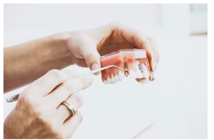 임플란트 장단점