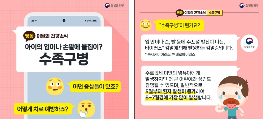 수족구병
