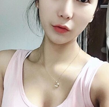 인중 축소 수술 후기