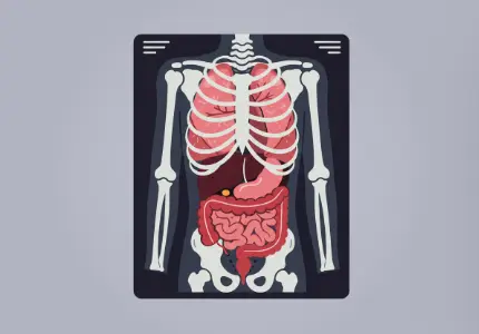 중입자암치료 중입자치료센터