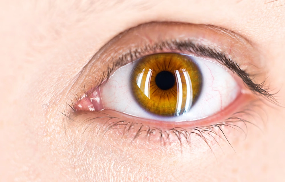 결막하 출혈 원인