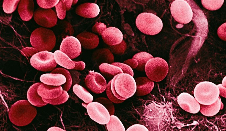 μκ°λͺ¨ ν
λΌν¨ν±μ€(SGMO), νμ΄μ νμ°λ³ A μ μ μ μΉλ£μ νλ³΄λ¬Όμ§ μμ 3μ μν κΈμ μ νλΌμΈ