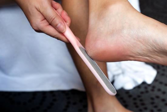 발 뒤꿈치 각질