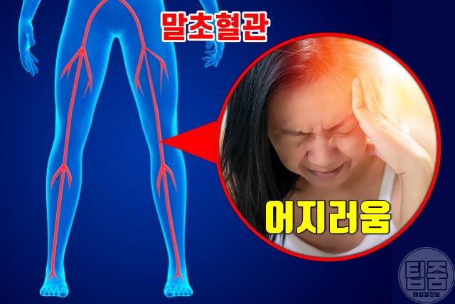 더위 먹은 증상 어지러움 메스꺼움 더위 먹었을때 대처 회복기간