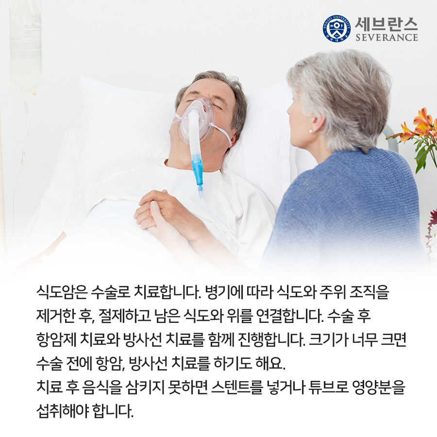 식도암