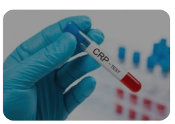 CRP 수치 정상범위