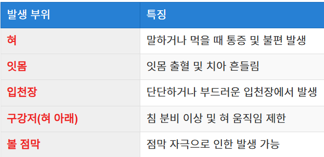 구강암이 발생하는 부위
