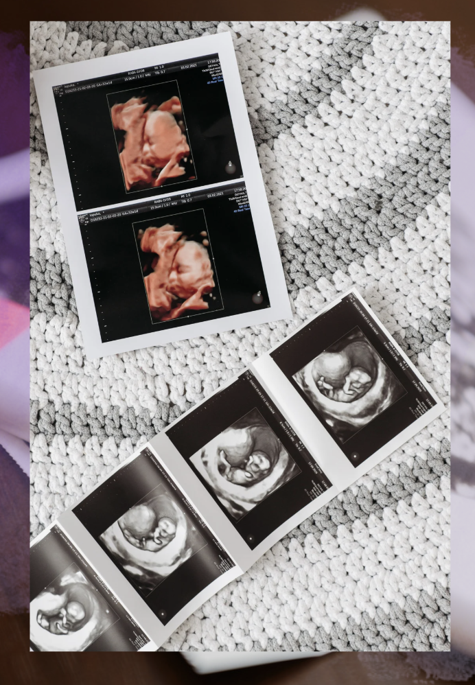 사후피임약, 사후피임약 처방, 사후피임약 복용, 피임약 부작용, 응급피임, 관계 후 피임, 사후피임약 효과, 피임약 복용 주의, 피임 방법, 여성 건강